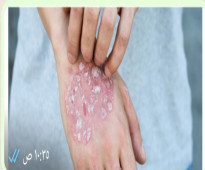 مشاكل الأمراض الجلدية